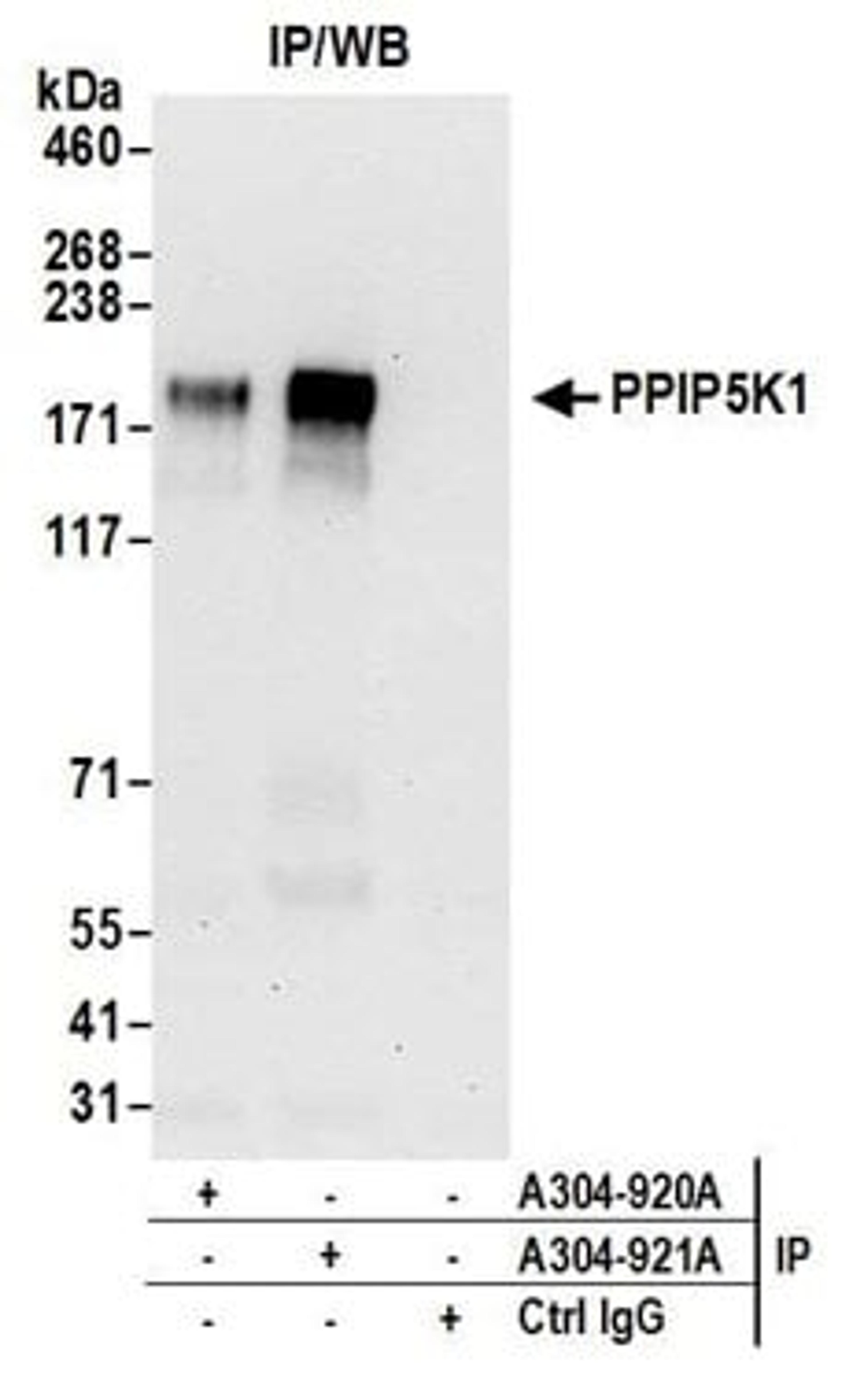 Detection of human PPIP5K1 by western blot of immunoprecipitates.