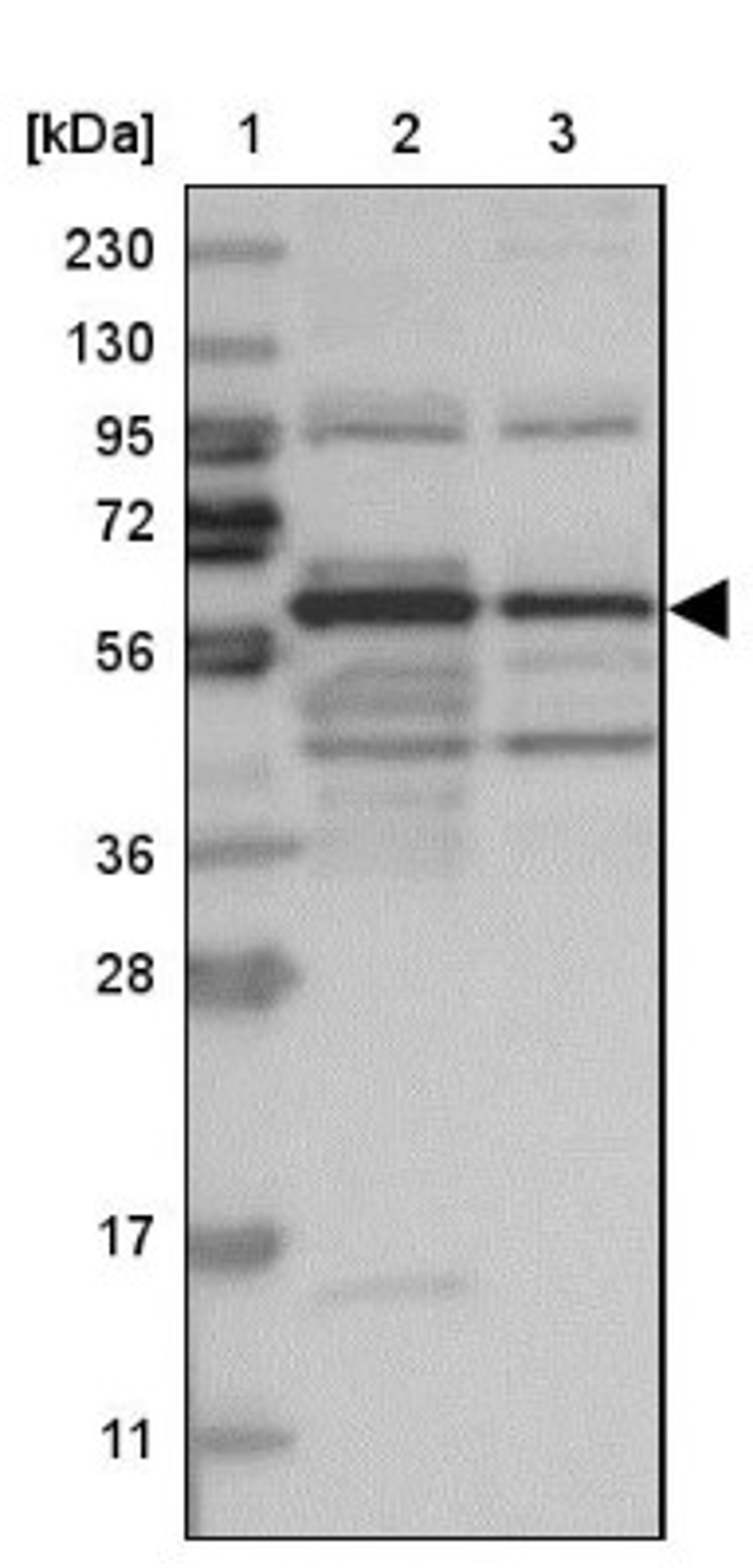 Western Blot: ARHGEF3 Antibody [NBP1-85130] - Lane 1: Marker [kDa] 230, 130, 95, 72, 56, 36, 28, 17, 11<br/>Lane 2: Human cell line RT-4<br/>Lane 3: Human cell line U-251MG sp