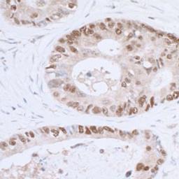 Detection of human p53 by immunohistochemistry.