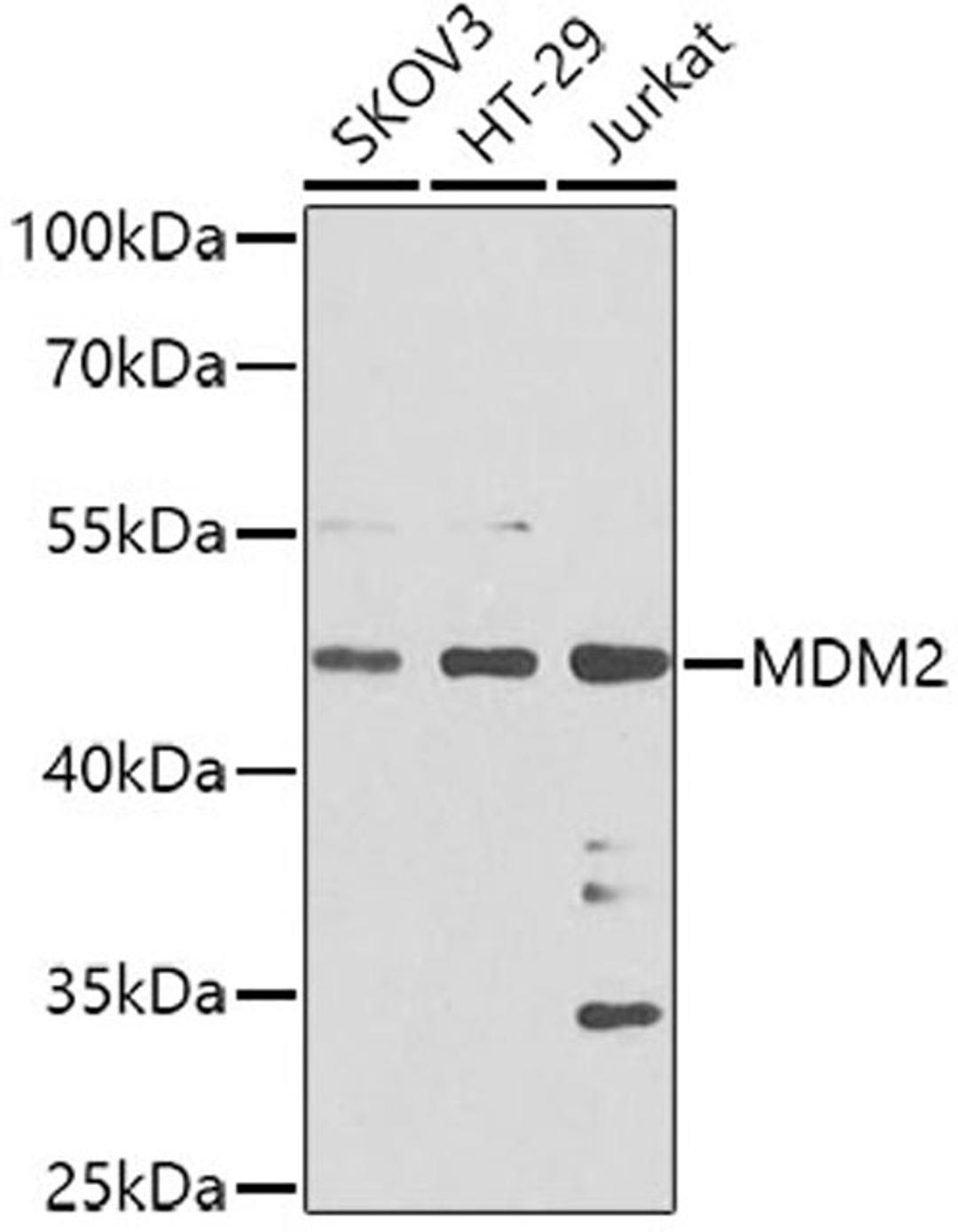 Western blot - MDM2 antibody (A0345)