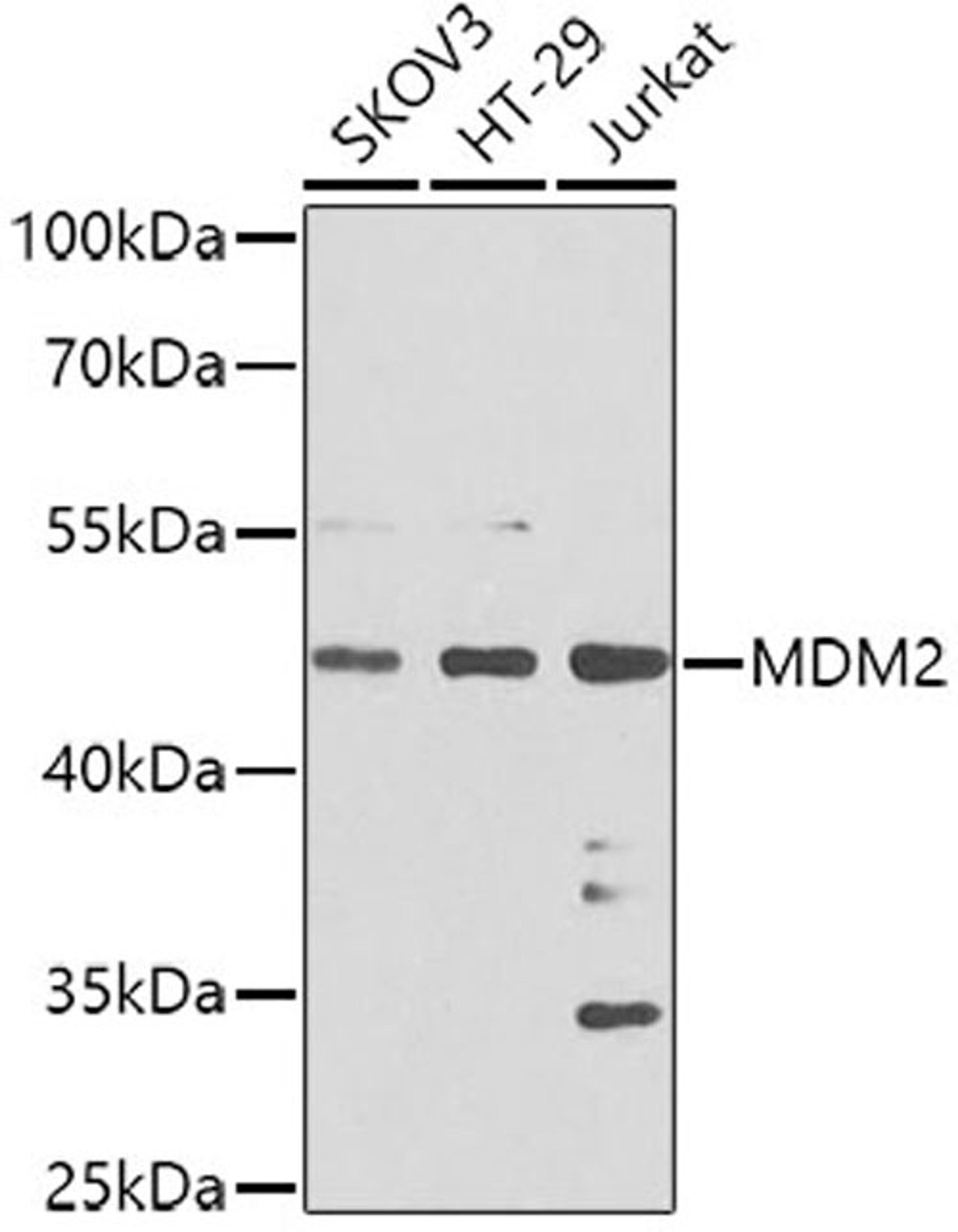 Western blot - MDM2 antibody (A0345)