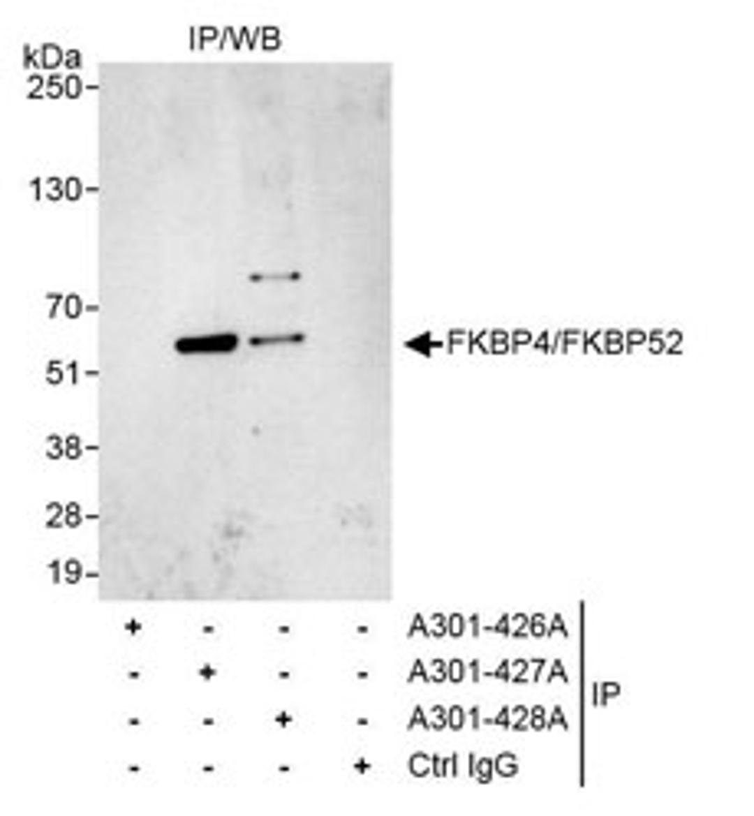 Detection of human FKBP4/FKBP52 by western blot of immunoprecipitates.