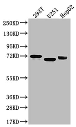 Western Blot. Positive WB detected in: U-87 whole cell lysate, 293T whole cell lysate, U-251 whole cell lysate, HepG2 whole cell lysate. All lanes: Serotonin transporter antibody at 1:1000. Secondary. Goat polyclonal to rabbit IgG at 1/50000 dilution. Predicted band size: 71, 75 kDa. Observed band size: 55 kDa. 