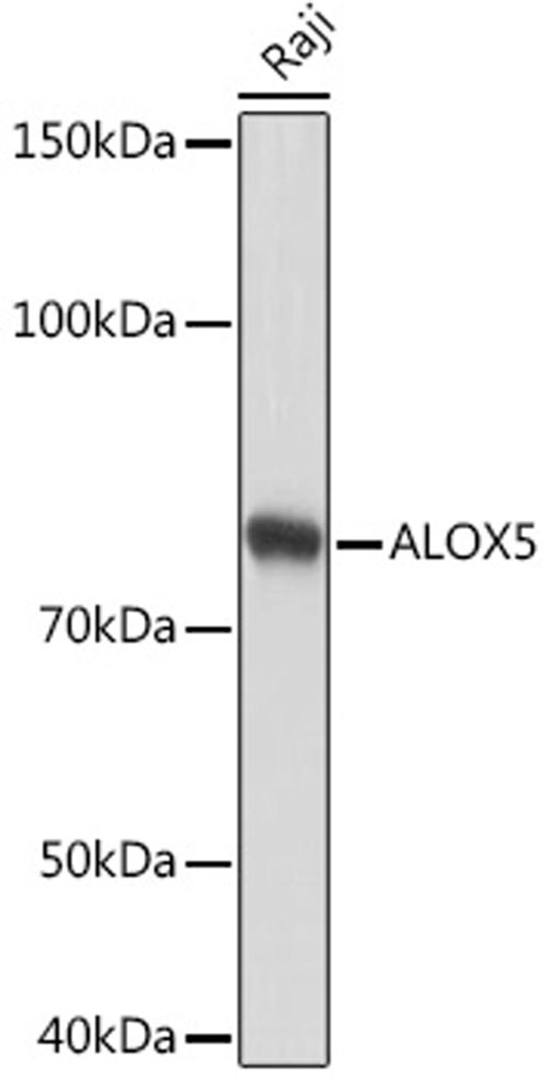 Western blot - ALOX5 Rabbit mAb (A2877)