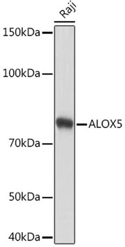 Western blot - ALOX5 Rabbit mAb (A2877)