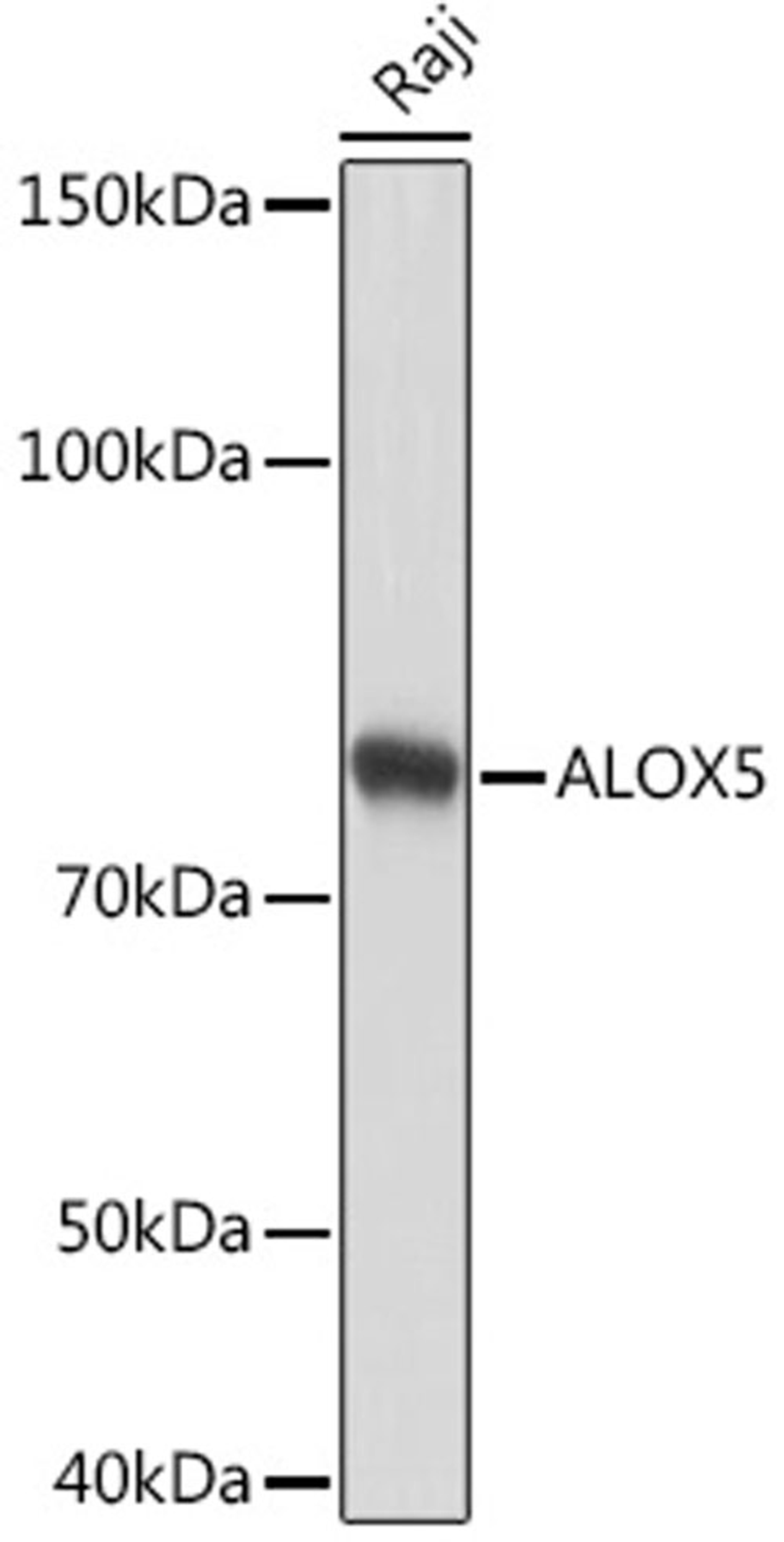 Western blot - ALOX5 Rabbit mAb (A2877)