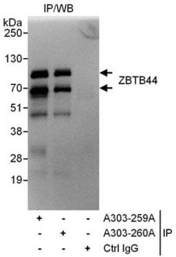 Detection of human ZBTB44 by western blot of immunoprecipitates.