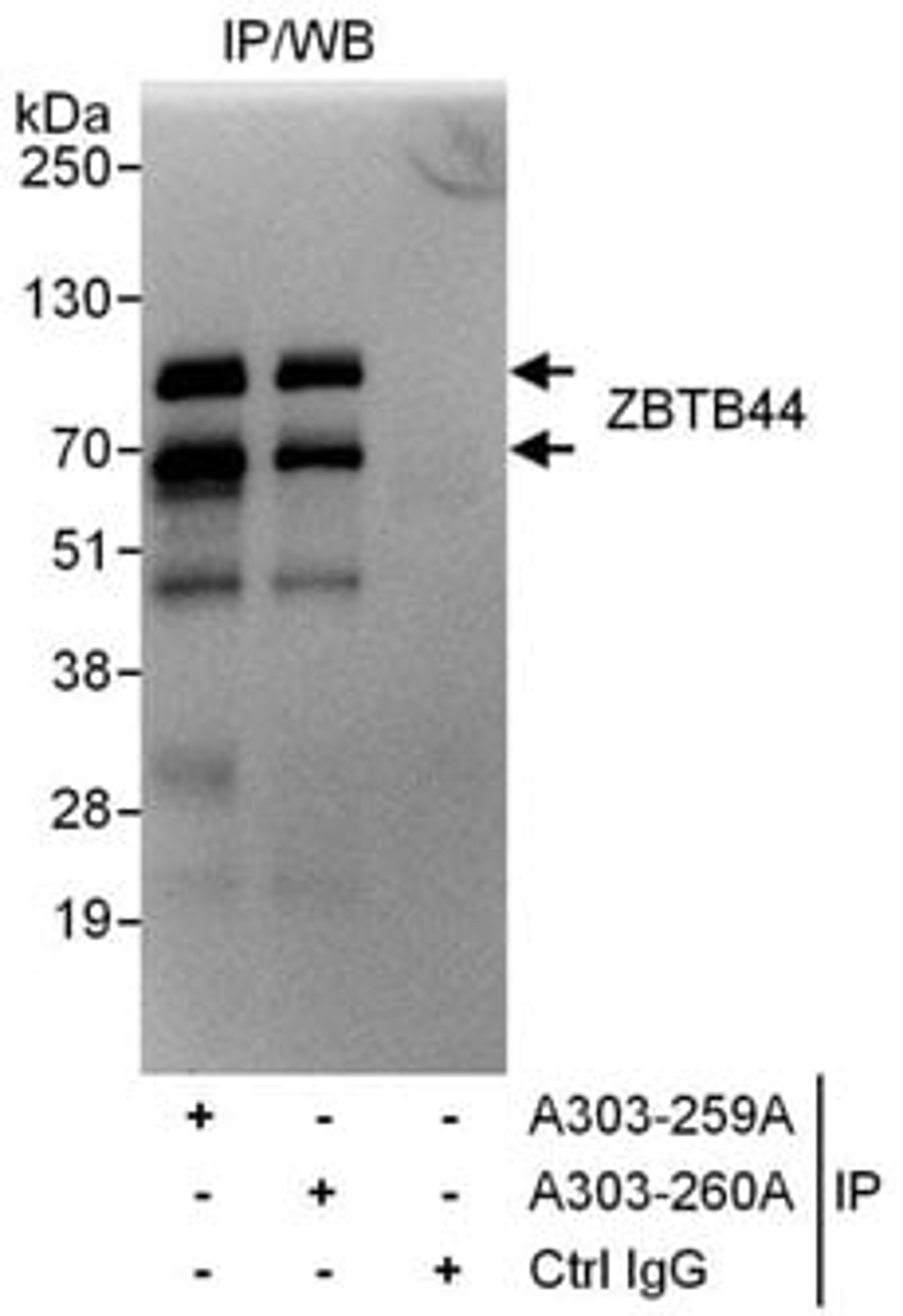 Detection of human ZBTB44 by western blot of immunoprecipitates.