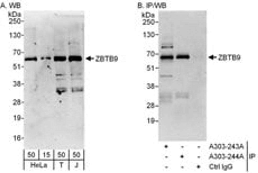 Detection of human ZBTB9 by western blot and immunoprecipitation.