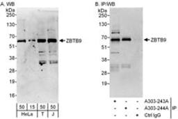 Detection of human ZBTB9 by western blot and immunoprecipitation.