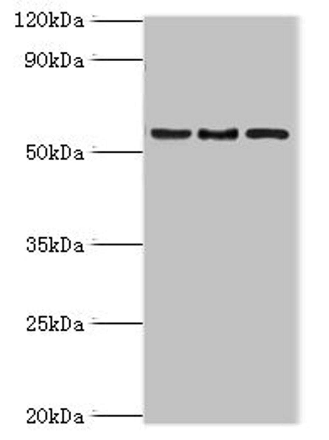 Western blot. All lanes: ARFGAP3 antibody at 4ug/ml. Lane 1: HepG2 whole cell lysate. Lane 2: Jurkat whole cell lysate. Lane 3: A549 whole cell lysate. Secondary. Goat polyclonal to rabbit IgG at 1/10000 dilution. Predicted band size: 57, 52 kDa. Observed band size: 57 kDa.