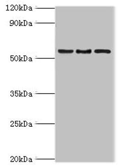 Western blot. All lanes: ARFGAP3 antibody at 4ug/ml. Lane 1: HepG2 whole cell lysate. Lane 2: Jurkat whole cell lysate. Lane 3: A549 whole cell lysate. Secondary. Goat polyclonal to rabbit IgG at 1/10000 dilution. Predicted band size: 57, 52 kDa. Observed band size: 57 kDa.
