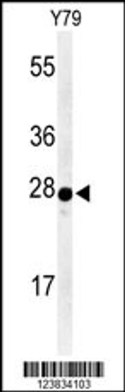 Western blot analysis of AANAT Antibody in Y79 cell line lysates (35ug/lane)