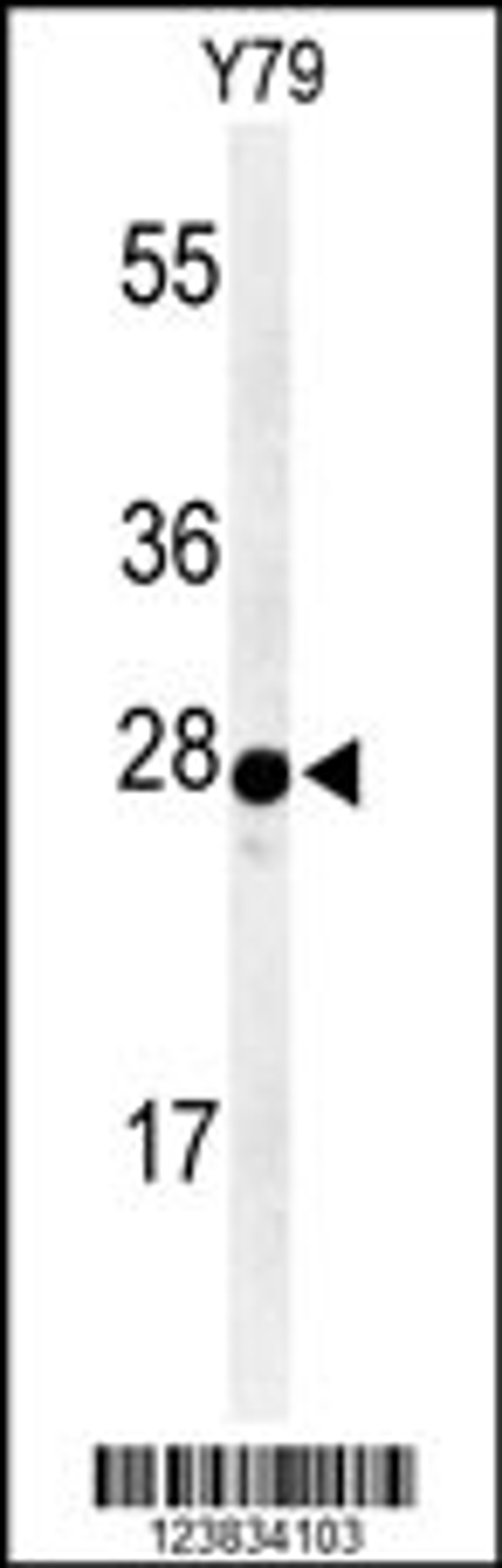 Western blot analysis of AANAT Antibody in Y79 cell line lysates (35ug/lane)