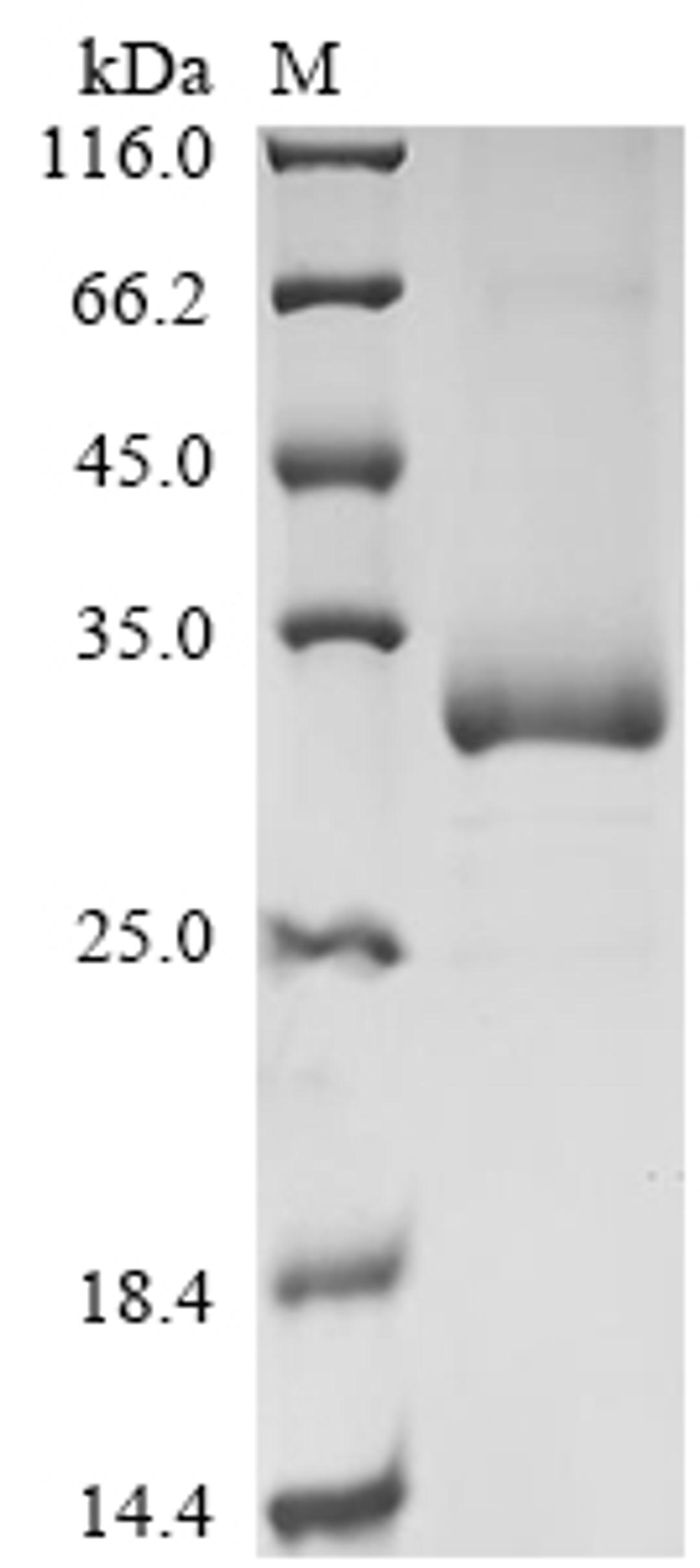 (Tris-Glycine gel) Discontinuous SDS-PAGE (reduced) with 5% enrichment gel and 15% separation gel.