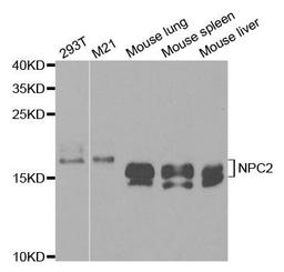 Western blot analysis of extracts of various cell lines using NPC2 antibody