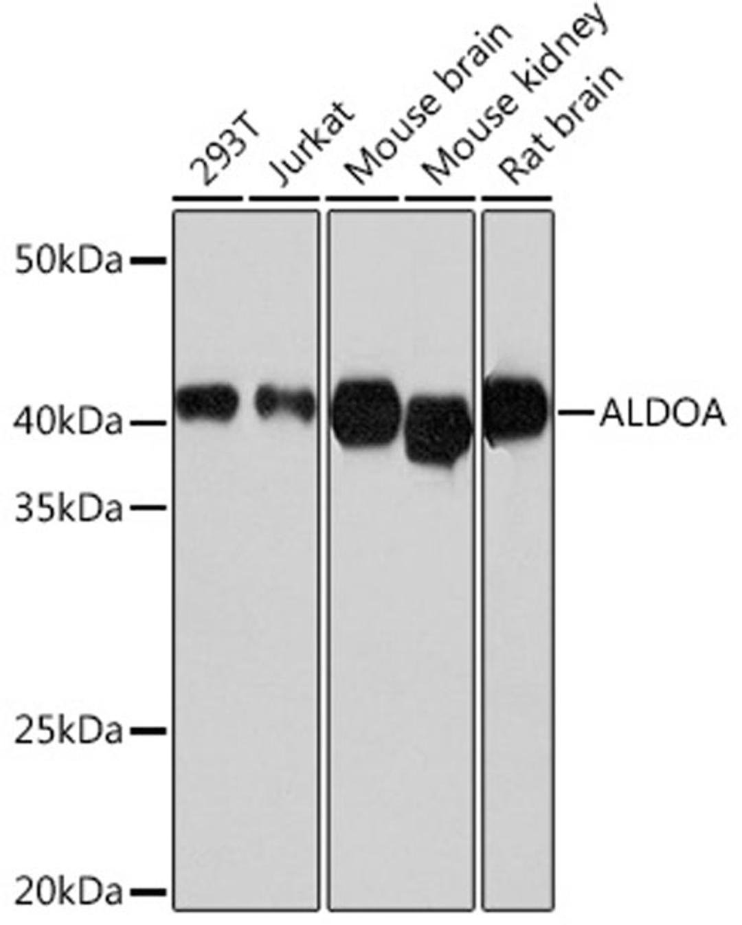 Western blot - ALDOA Rabbit mAb (A11445)