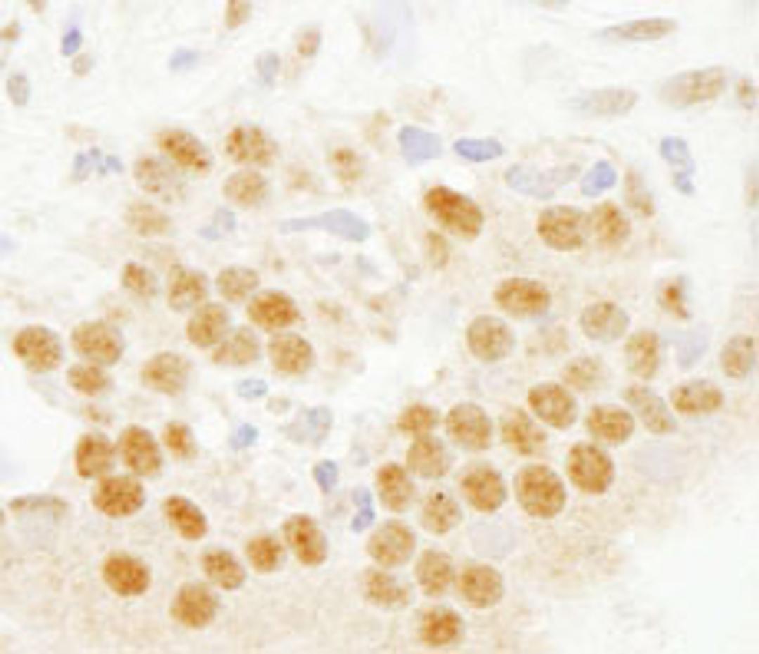 Detection of human SET7 by immunohistochemistry.