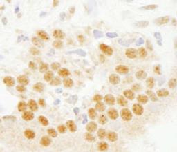 Detection of human SET7 by immunohistochemistry.