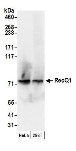 Detection of human RecQ1 by western blot.