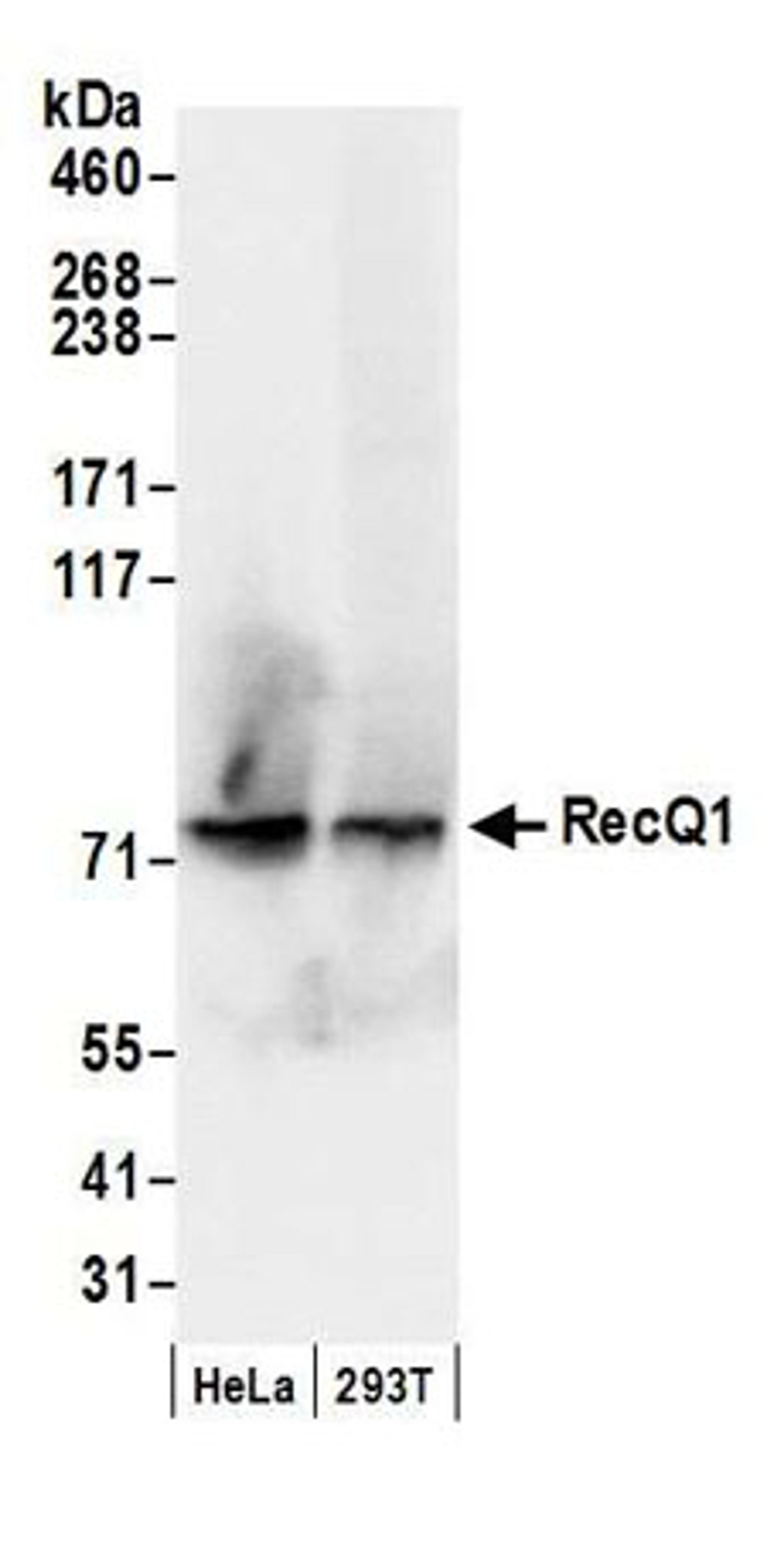 Detection of human RecQ1 by western blot.