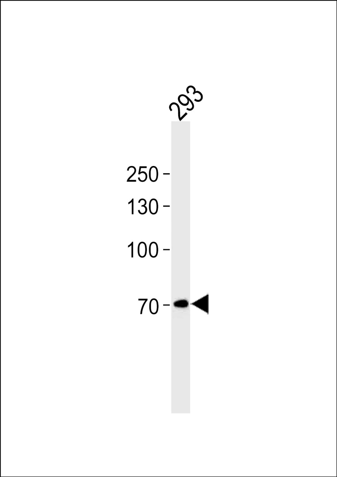 Western blot analysis in 293 cell line lysates (35ug/lane).