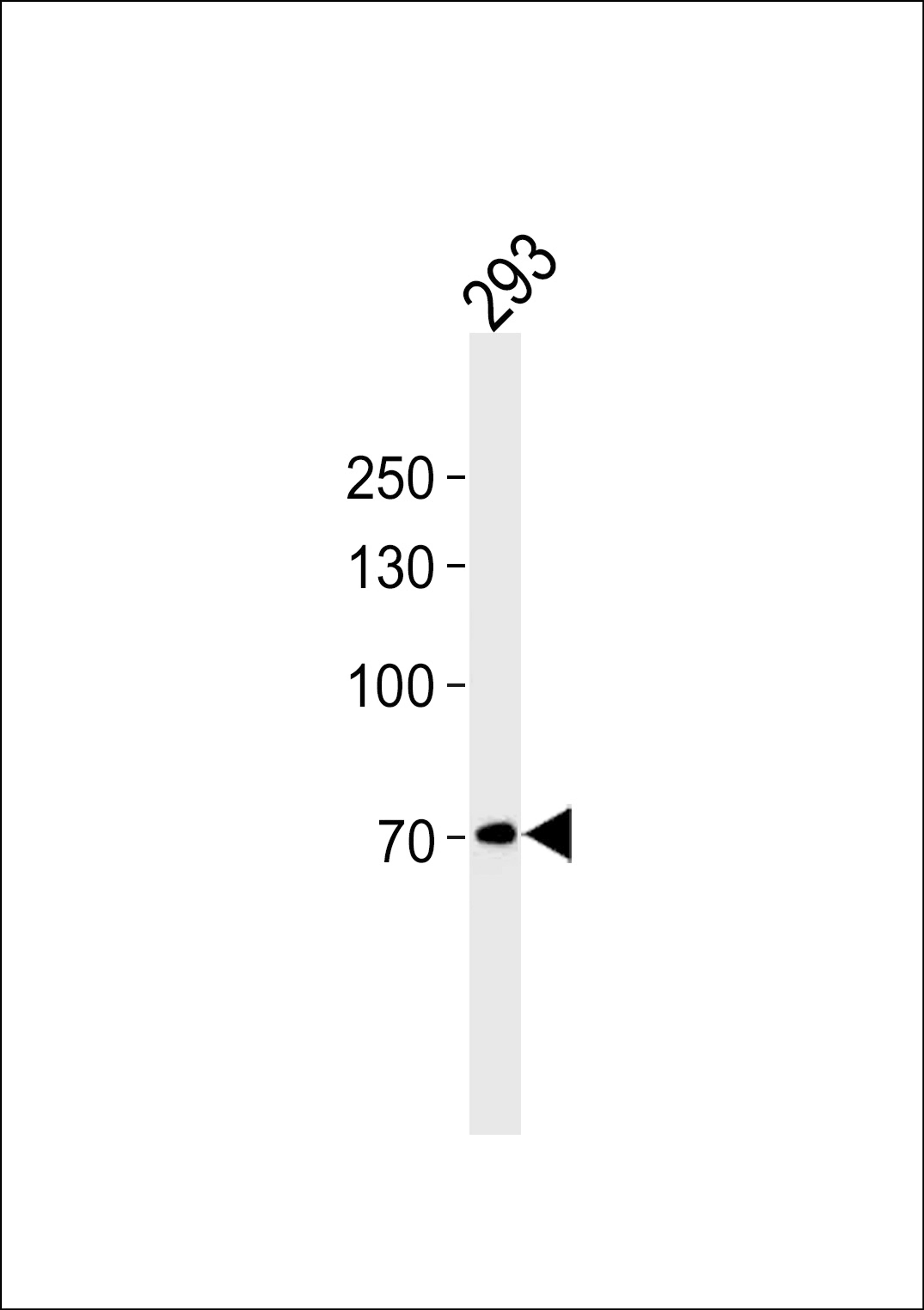 Western blot analysis in 293 cell line lysates (35ug/lane).