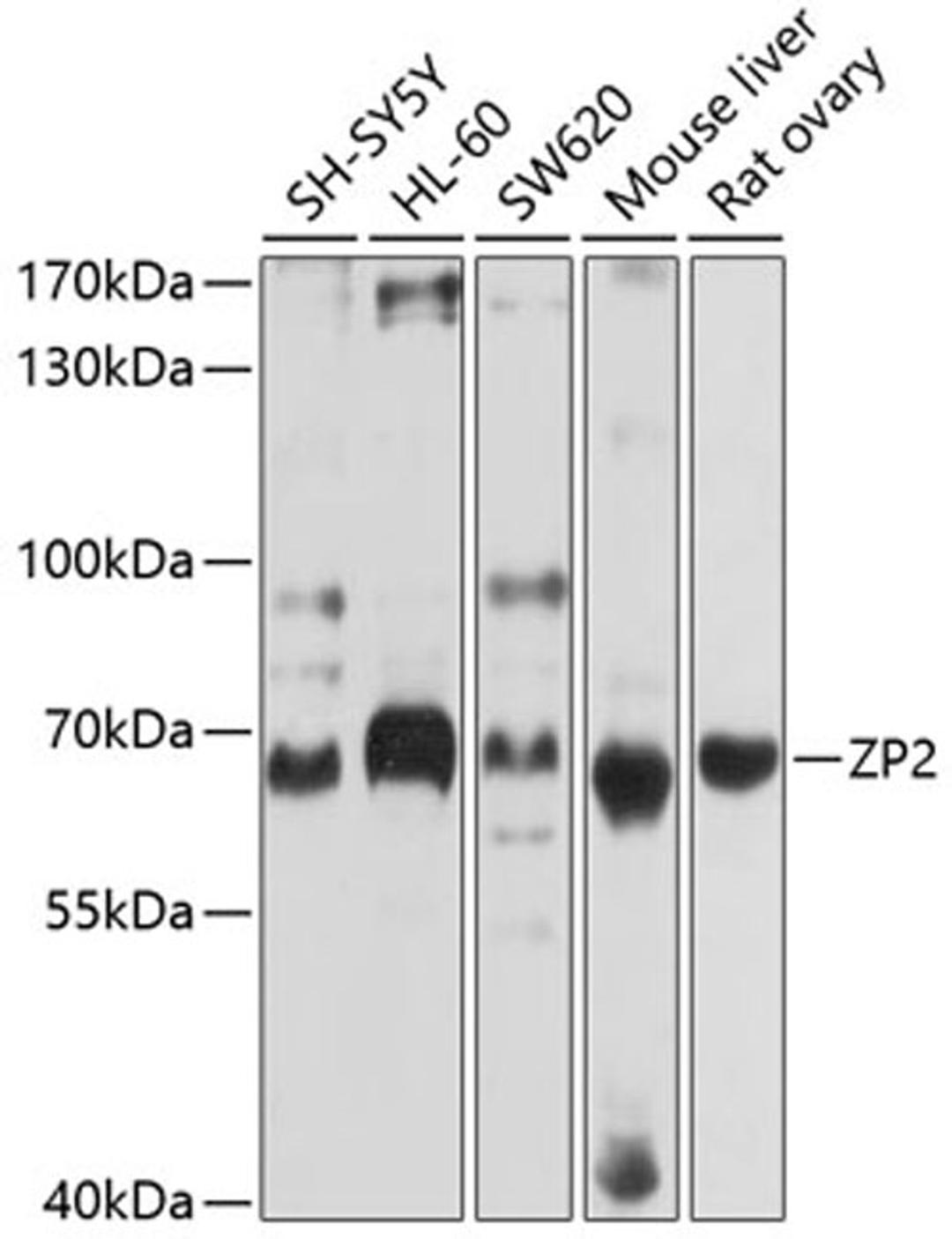 Western blot - ZP2 antibody (A10126)