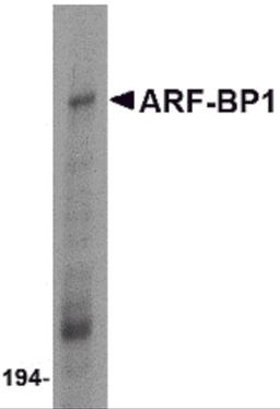 Western blot analysis of ARF-BP1 in Daudi cell lysate with ARF-BP1 antibody at 1 μg/mL.
