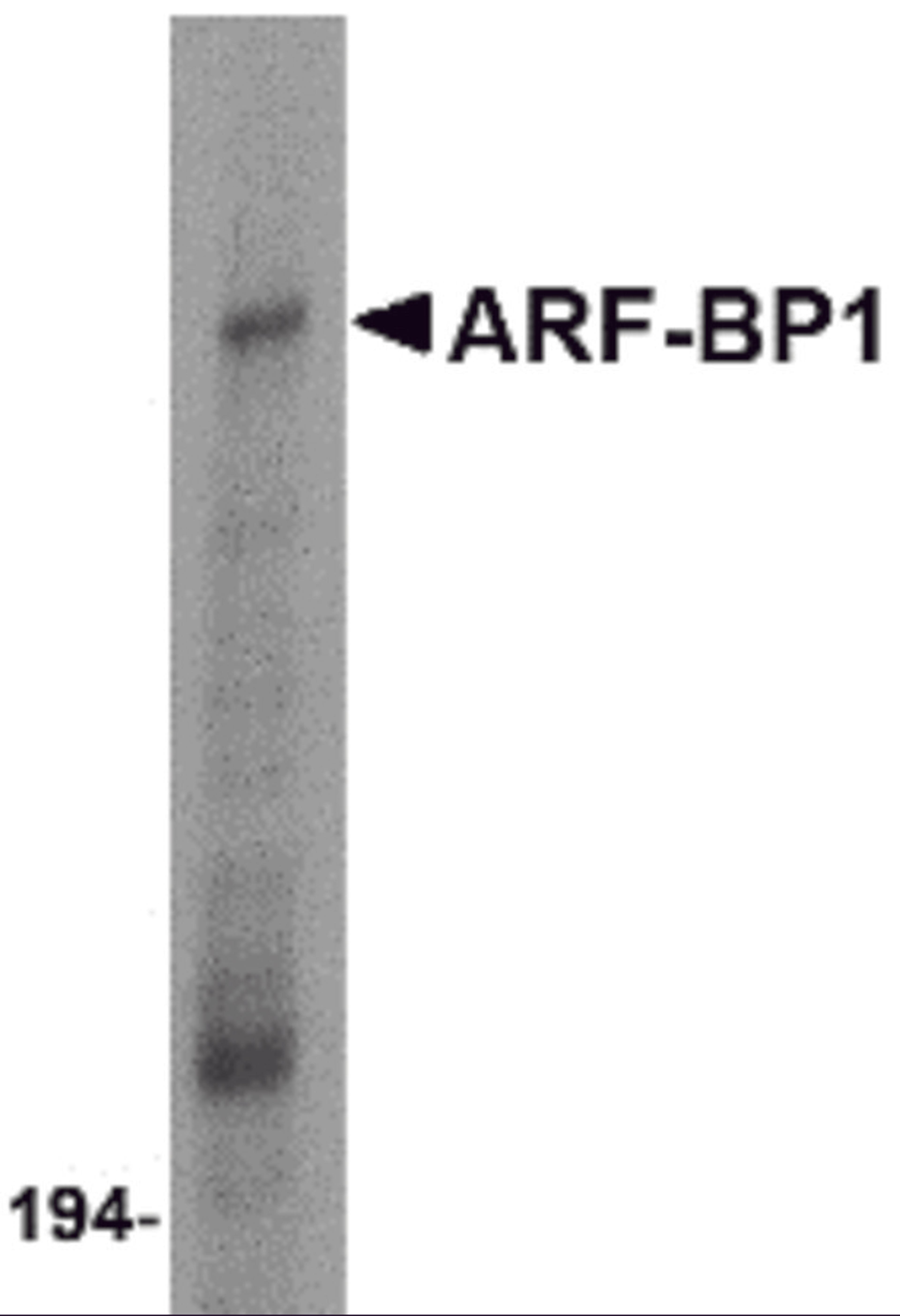 Western blot analysis of ARF-BP1 in Daudi cell lysate with ARF-BP1 antibody at 1 μg/mL.