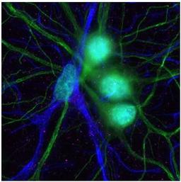 Immunocytochemistry/ Immunofluorescence - Anti-MAP2 antibody