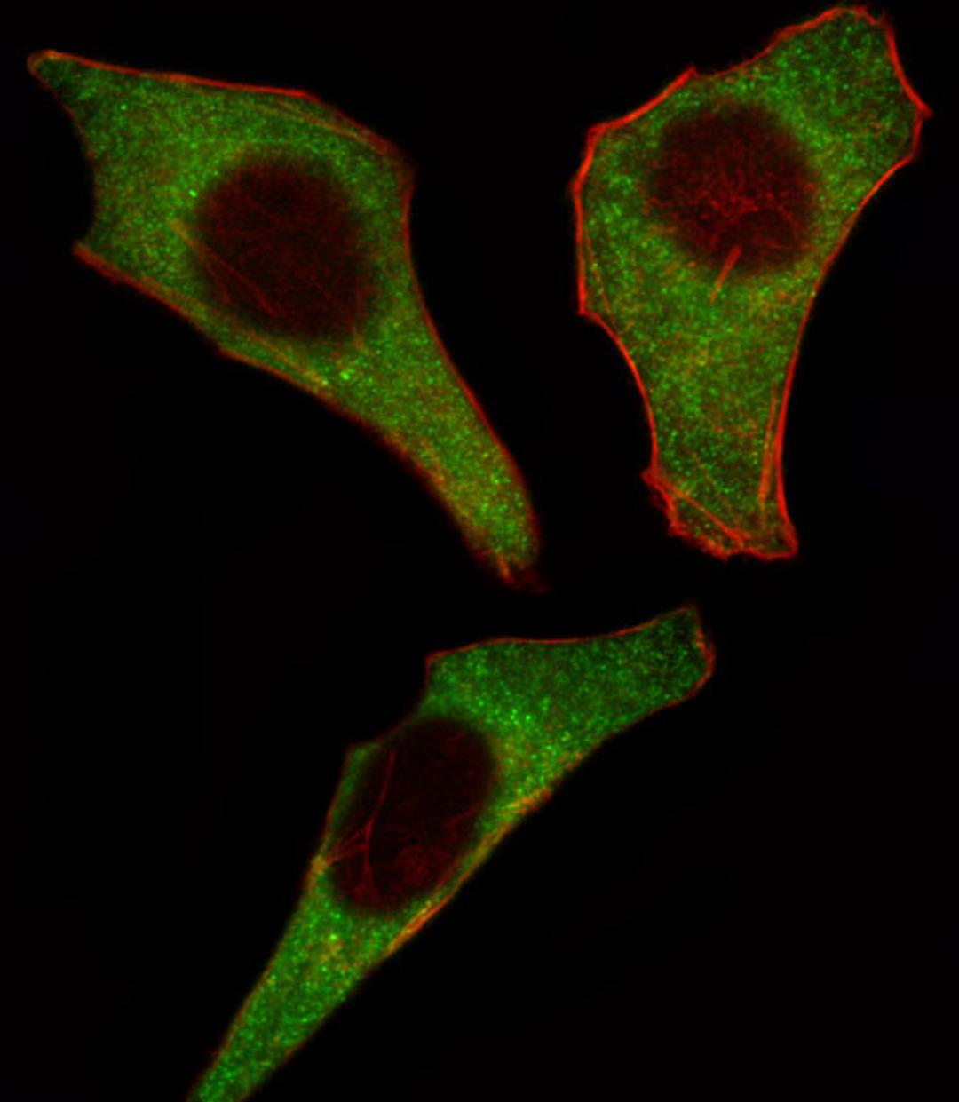 Fluorescent image of Hela cell stained with CDK4 Antibody .Hela cells were fixed with 4% PFA (20 min), permeabilized with Triton X-100 (0.1%, 10 min), then incubated with CDK4 primary antibody (1:25). For secondary antibody, Alexa Fluor 488 conjugated don