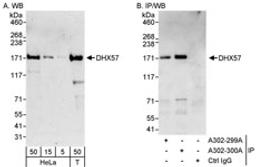 Detection of human DHX57 by western blot and immunoprecipitation.