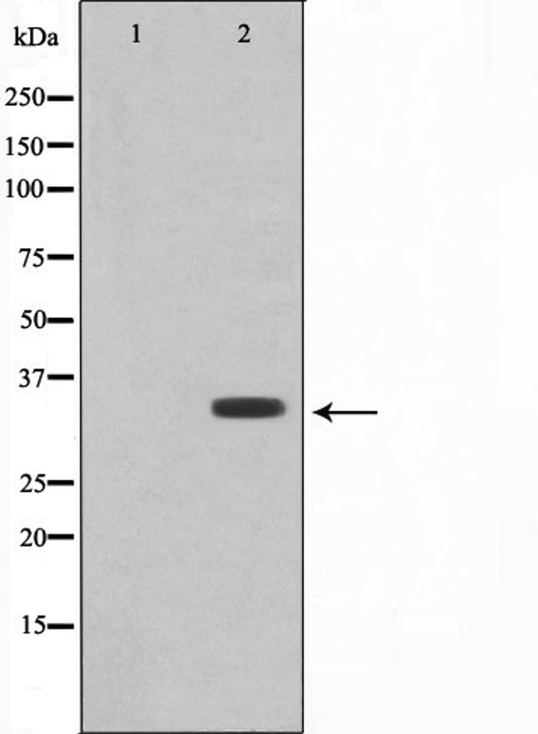 Western blot analysis of RAW264.7 cell lysate using COX11 antibody