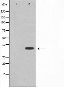 Western blot analysis of RAW264.7 cell lysate using COX11 antibody