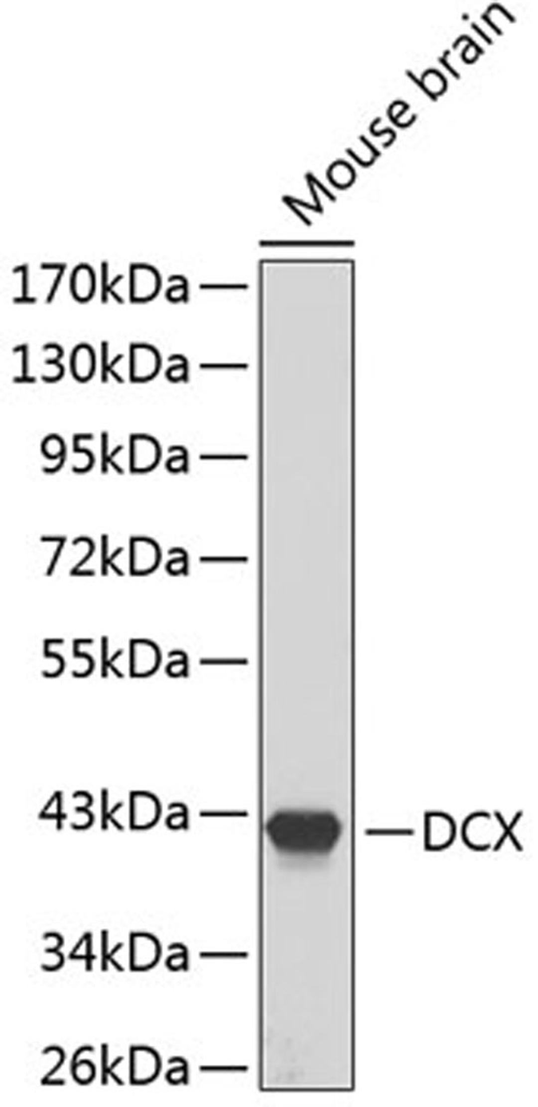 Western blot - DCX antibody (A1134)