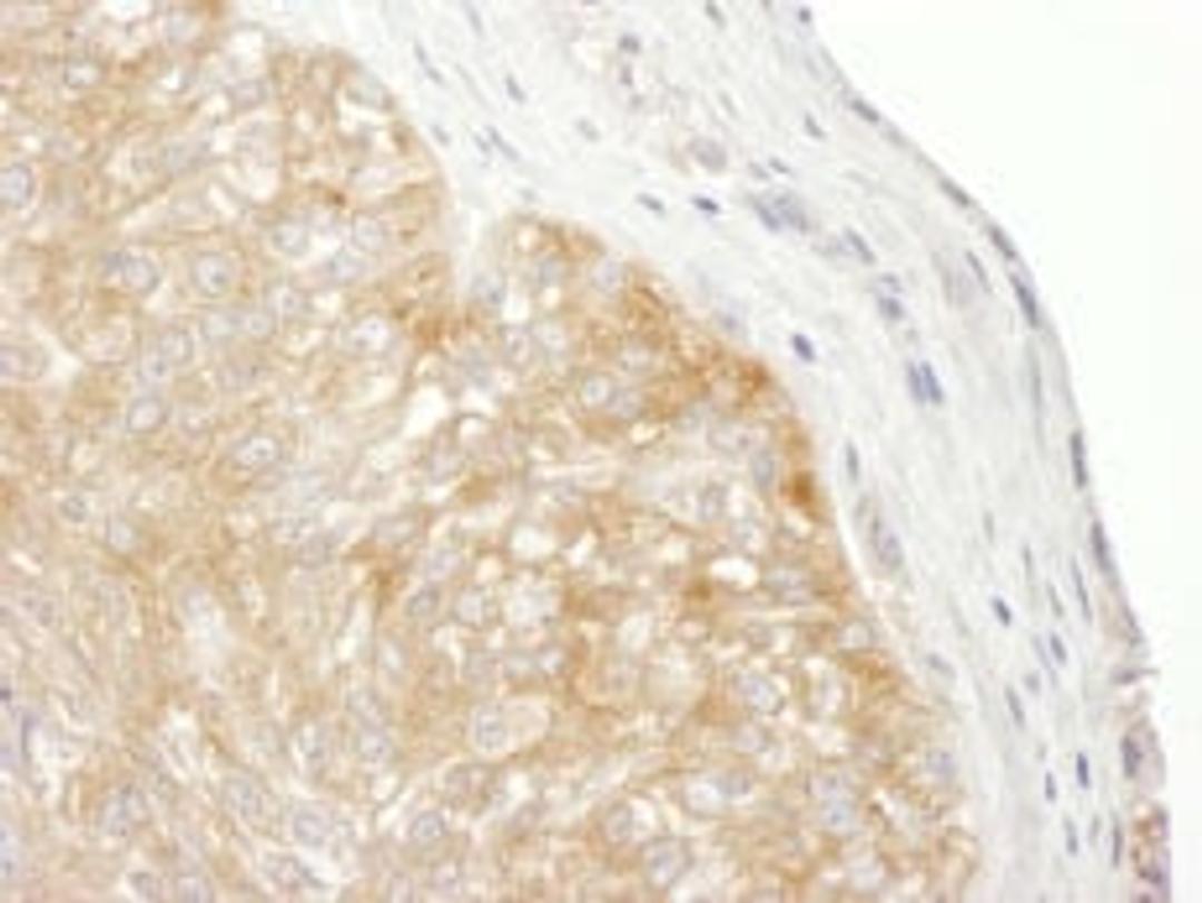 Detection of human RPS9 by immunohistochemistry.