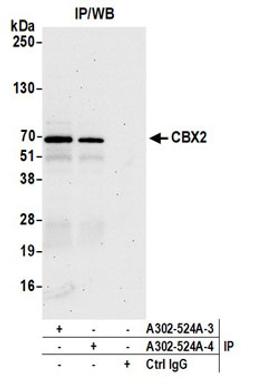 Detection of human CBX2 by western blot of immunoprecipitates.