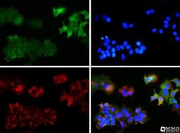 Immunocytochemistry/Immunofluorescence: Notch-4 Antibody [NB100-93551] -  Notch-4 antibody (1:500) was tested in HeLa cells with Dylight 488 (green). Nuclei and alpha-tubulin were counterstained with DAPI (blue) and Dylight 550 (red). Image objective 20x.