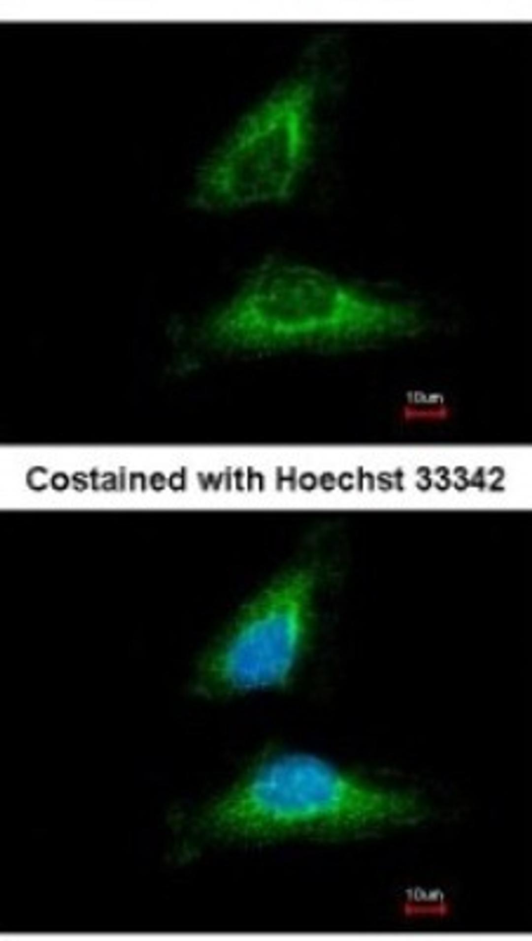 Immunocytochemistry/Immunofluorescence: EML1 Antibody [NBP1-30956] - Analysis of methanol-fixed HeLa, using antibody at 1:500 dilution.