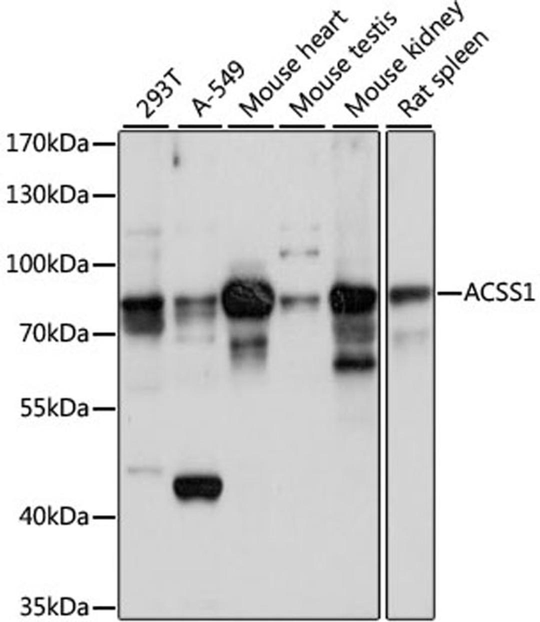 Western blot - ACSS1 antibody (A15007)