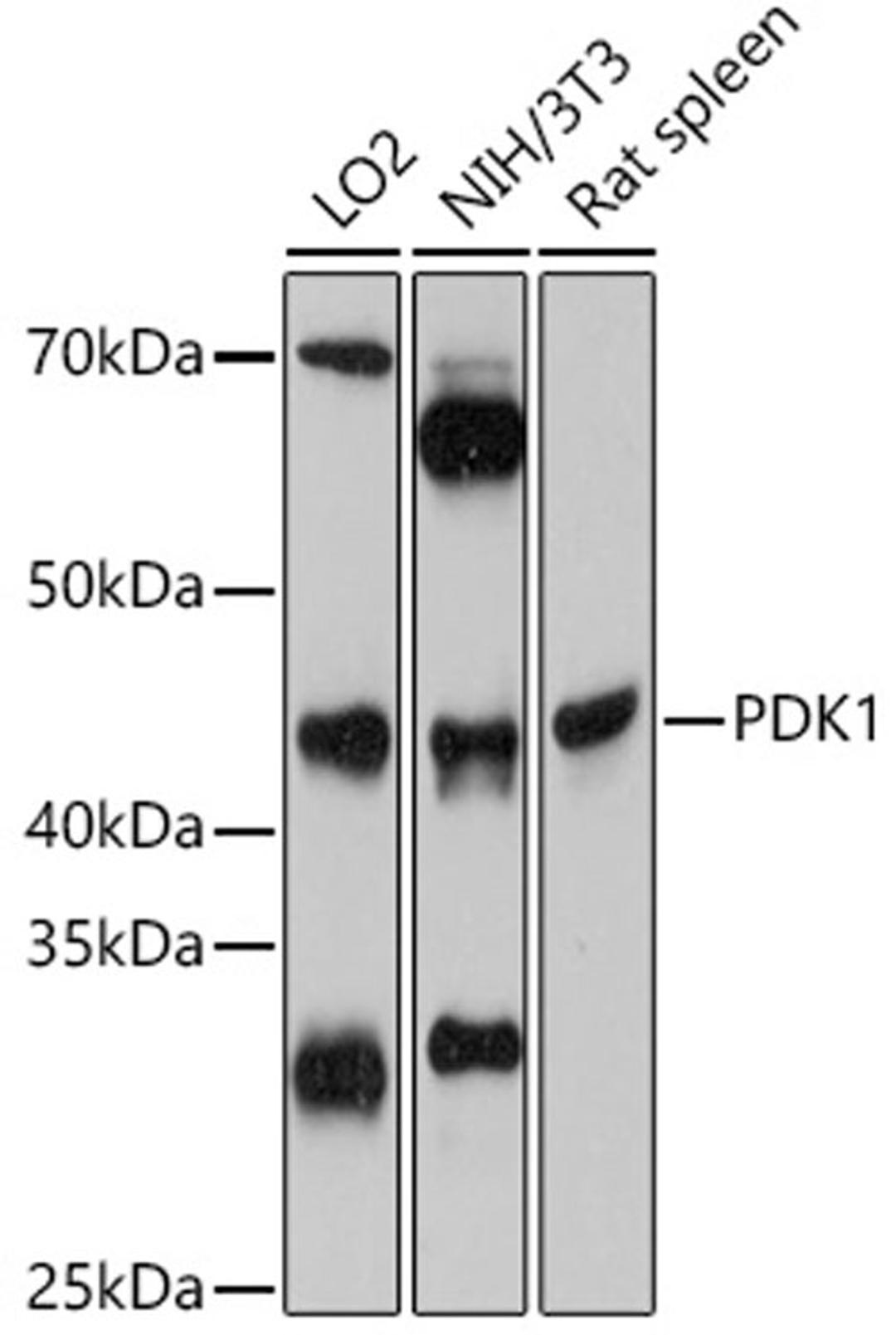 Western blot - PDK1 antibody (A0834)