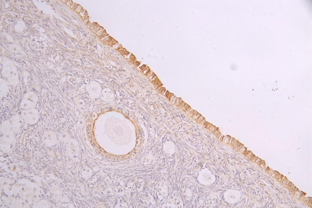 IHC image of CSB-RA932279MA1HU diluted at 1:100 and staining in paraffin-embedded human ovarian tissue performed on a Leica BondTM system. After dewaxing and hydration, antigen retrieval was mediated by high pressure in a citrate buffer (pH 6.0). Section was blocked with 10% normal goat serum 30min at RT. Then primary antibody (1% BSA) was incubated at 4°C overnight. The primary is detected by a Goat anti-human polymer IgG labeled by HRP and visualized using 0.05% DAB.