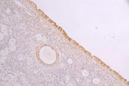 IHC image of CSB-RA932279MA1HU diluted at 1:100 and staining in paraffin-embedded human ovarian tissue performed on a Leica BondTM system. After dewaxing and hydration, antigen retrieval was mediated by high pressure in a citrate buffer (pH 6.0). Section was blocked with 10% normal goat serum 30min at RT. Then primary antibody (1% BSA) was incubated at 4°C overnight. The primary is detected by a Goat anti-human polymer IgG labeled by HRP and visualized using 0.05% DAB.