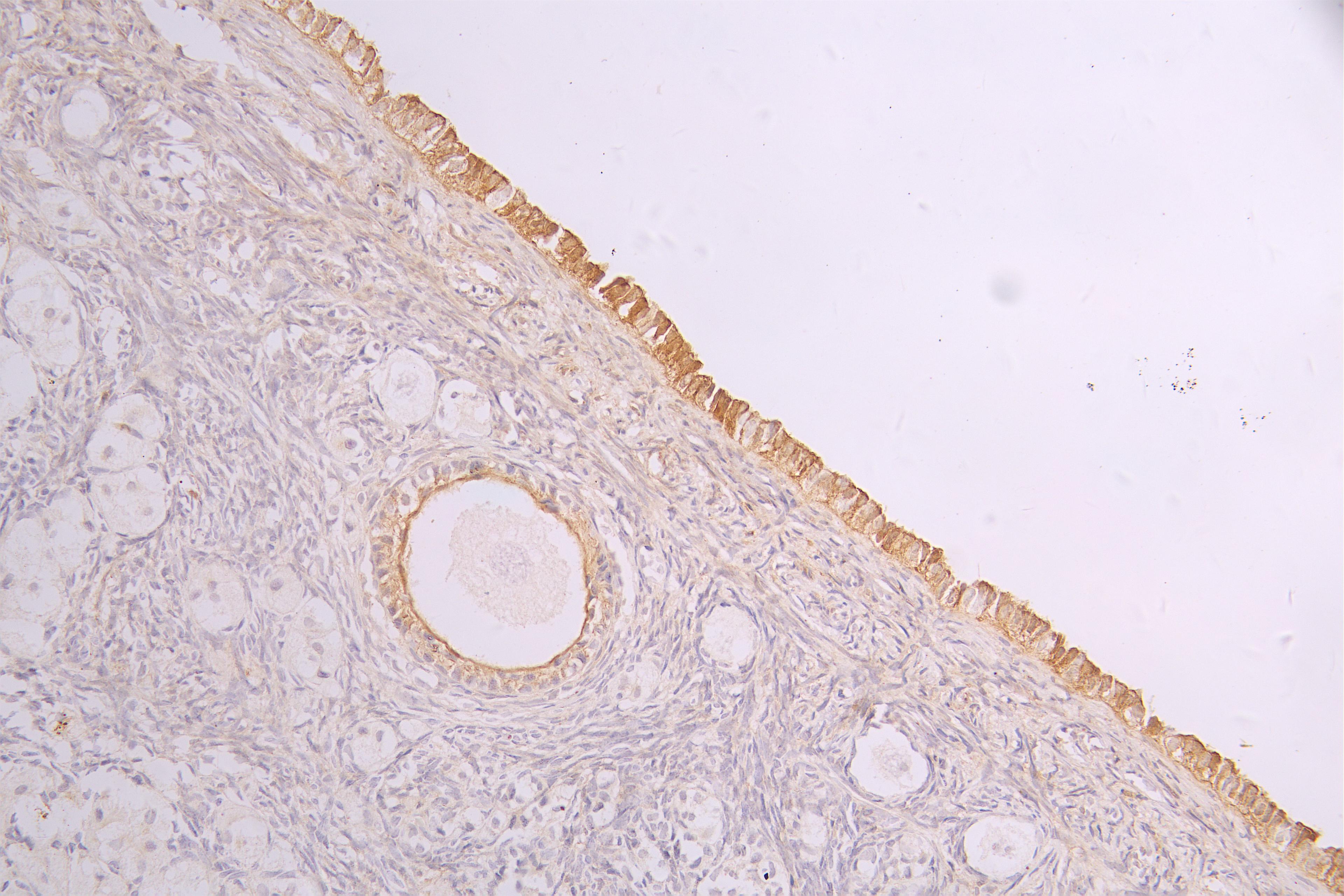 IHC image of CSB-RA932279MA1HU diluted at 1:100 and staining in paraffin-embedded human ovarian tissue performed on a Leica BondTM system. After dewaxing and hydration, antigen retrieval was mediated by high pressure in a citrate buffer (pH 6.0). Section was blocked with 10% normal goat serum 30min at RT. Then primary antibody (1% BSA) was incubated at 4°C overnight. The primary is detected by a Goat anti-human polymer IgG labeled by HRP and visualized using 0.05% DAB.