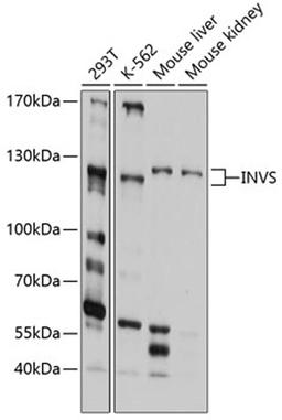 Western blot - INVS antibody (A10298)