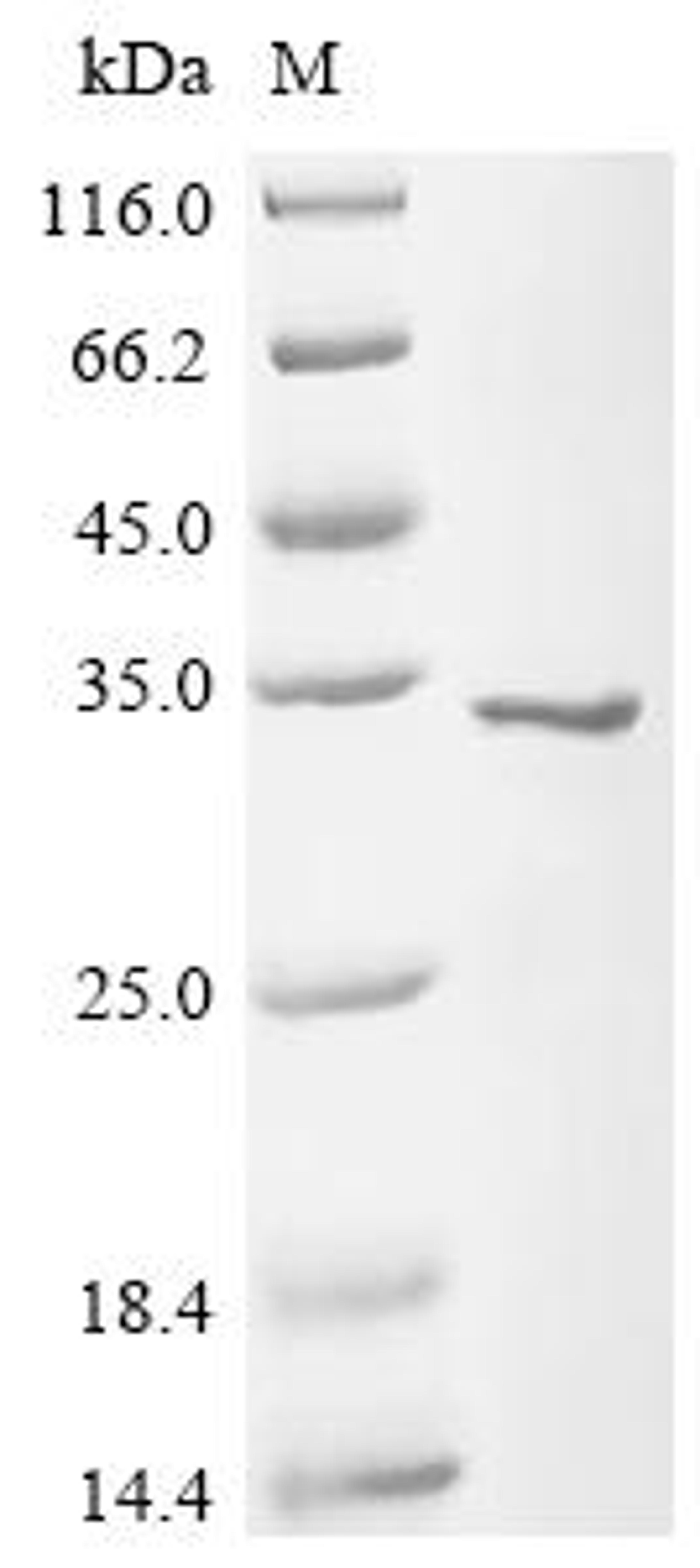(Tris-Glycine gel) Discontinuous SDS-PAGE (reduced) with 5% enrichment gel and 15% separation gel.