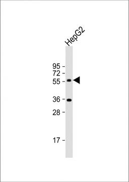 Western Blot at 1:1000 dilution + HepG2 whole cell lysate Lysates/proteins at 20 ug per lane.