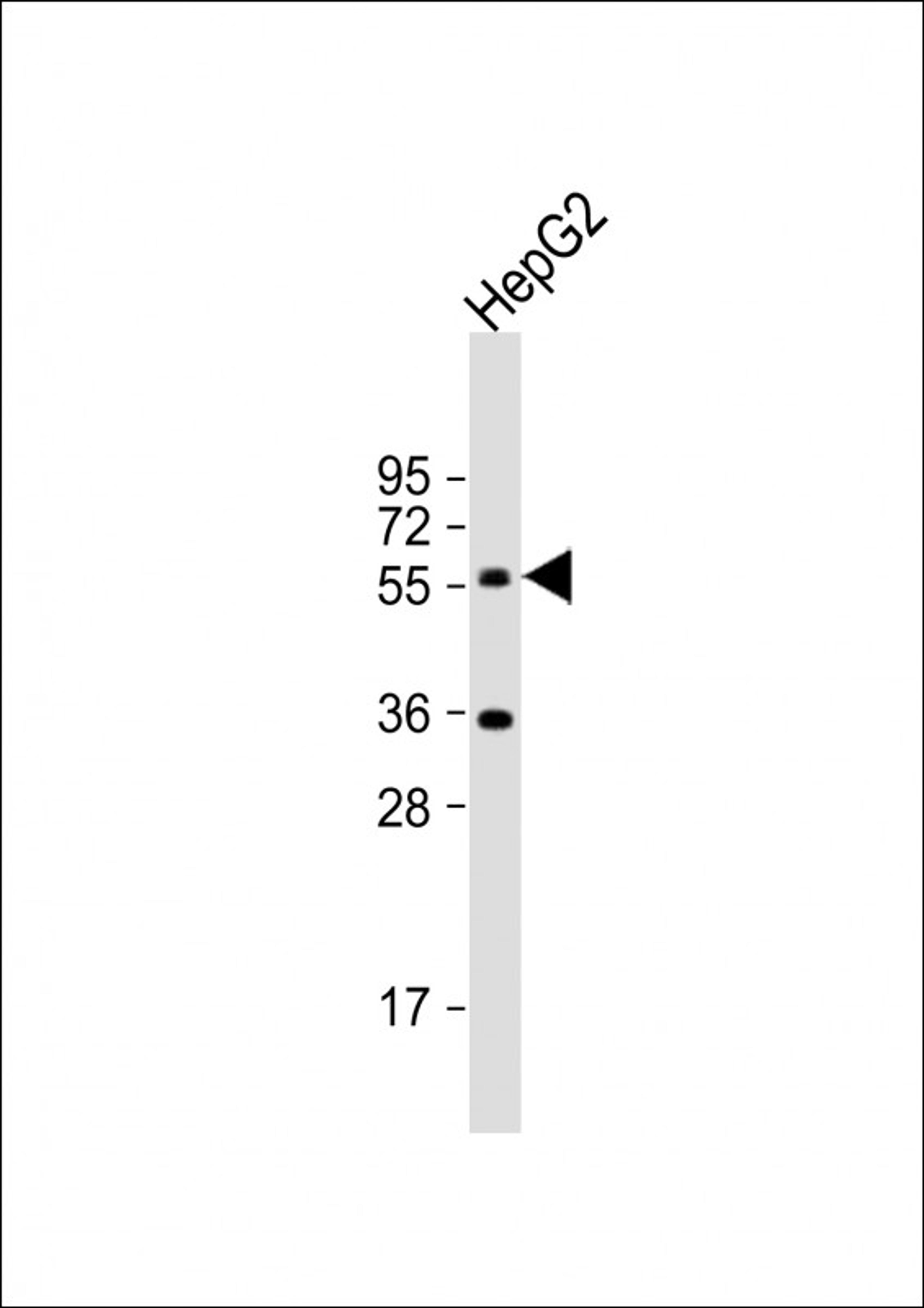 Western Blot at 1:1000 dilution + HepG2 whole cell lysate Lysates/proteins at 20 ug per lane.