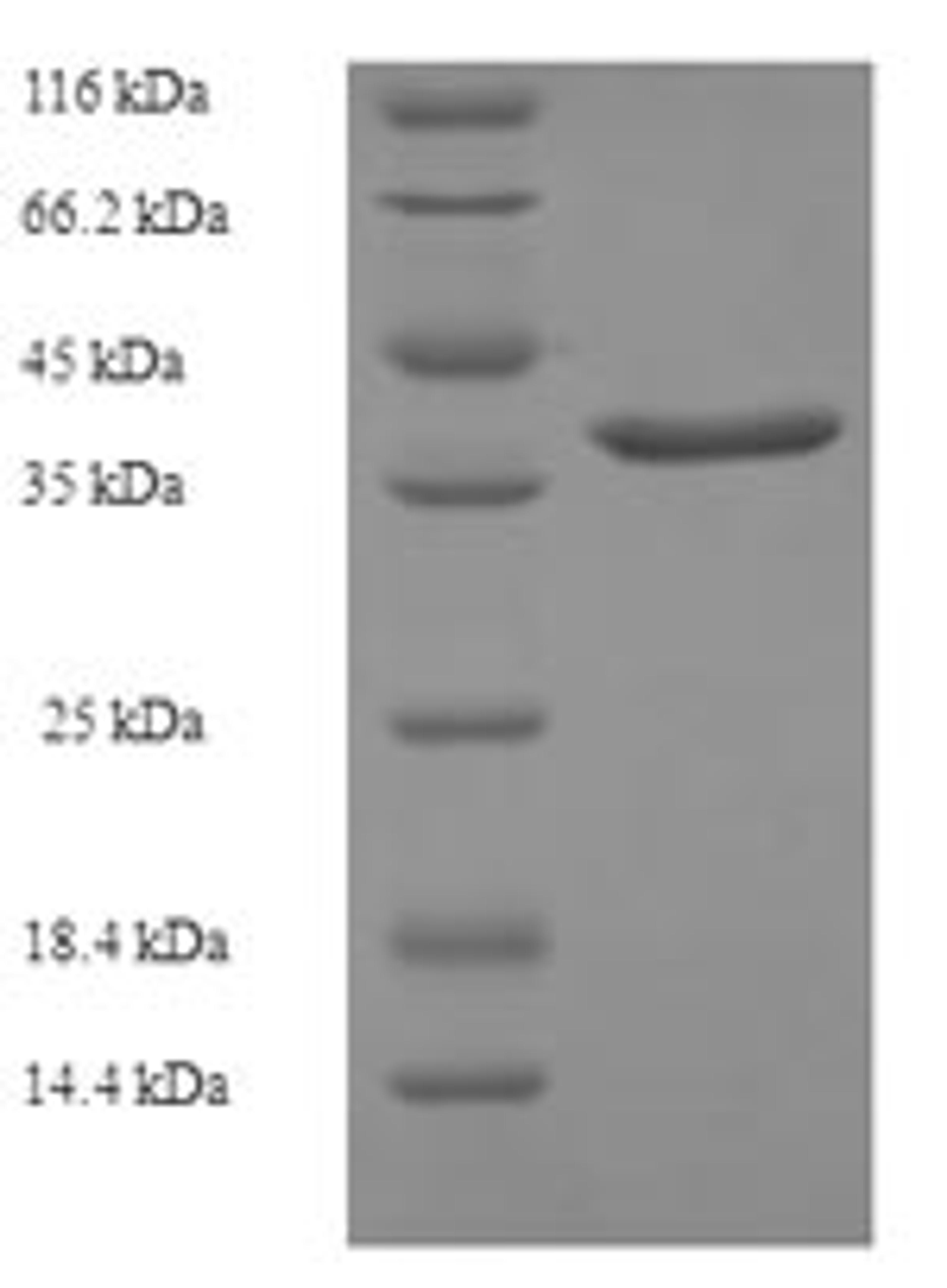 (Tris-Glycine gel) Discontinuous SDS-PAGE (reduced) with 5% enrichment gel and 15% separation gel.